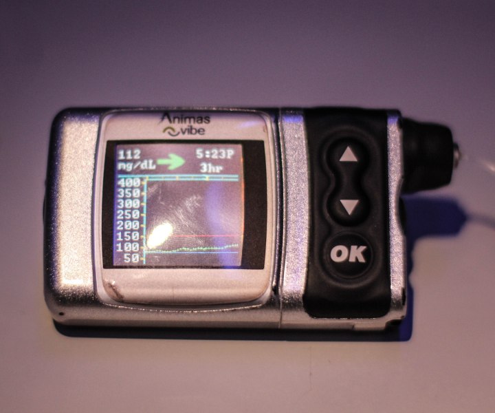 The Case for Continuous Glucose&nbsp;Monitors